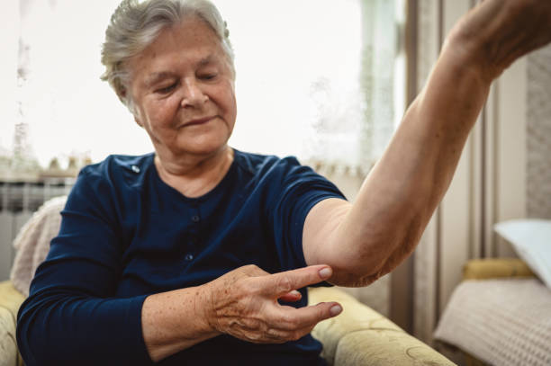 先輩女性はリウマチに苦しむ彼女の肘を示しています - arthritis senior adult rheumatoid arthritis sadness ストックフォトと画像