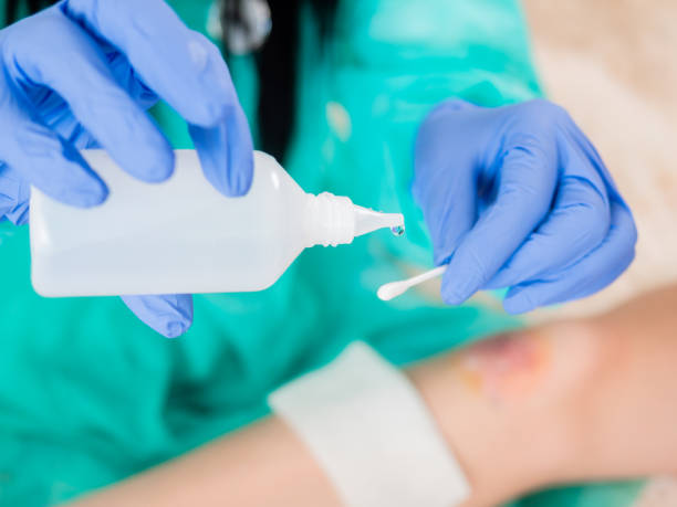 Close-up of a cotton swab and a bottle of antiseptic in the hands of a doctor against the background of a wound on the patient's leg. The doctor's hands in blue sterile gloves pours antiseptic on a cotton swab to treat the patient's abrasions. hydrogen peroxide stock pictures, royalty-free photos & images