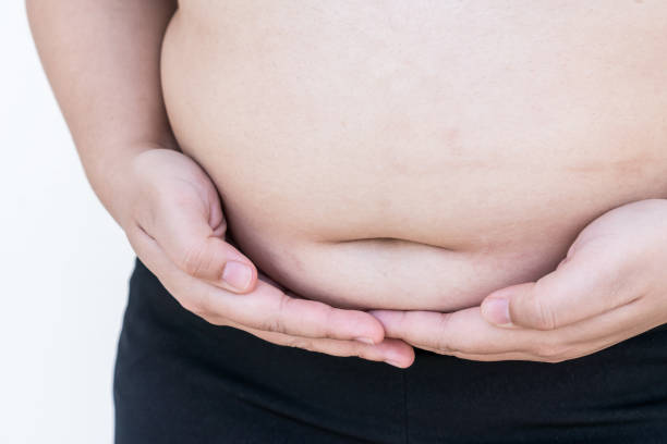 Overweight Heavy Asian young woman pinching her belly fat in sportswear, overeating problem, obesity. Weight people having more body fat than is optimally, body mass index (BMI), unhealthy concept sobrepeso heavy mujer asiática pellizcando su grasa del vientre en ropa deportiva, problema de exceso, obesidad. peso personas que tienen más grasa corporal de lo que es óptimamente, índice de masa corporal (imc), concepto poco saludable