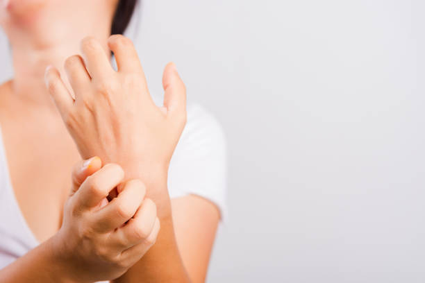 istock Asian beautiful woman itching her useing hand scratch itch hand 1251119796