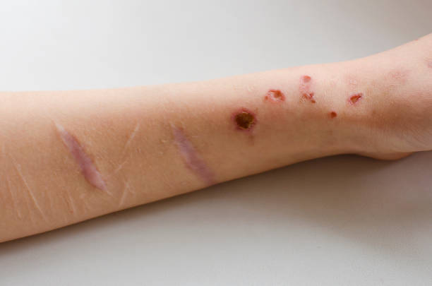istock female hand with cuts after suicide attempt 1251155057
