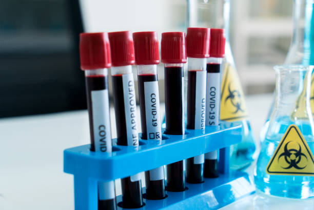 istock Covid-19 blood simple in laboratory. 1251250592