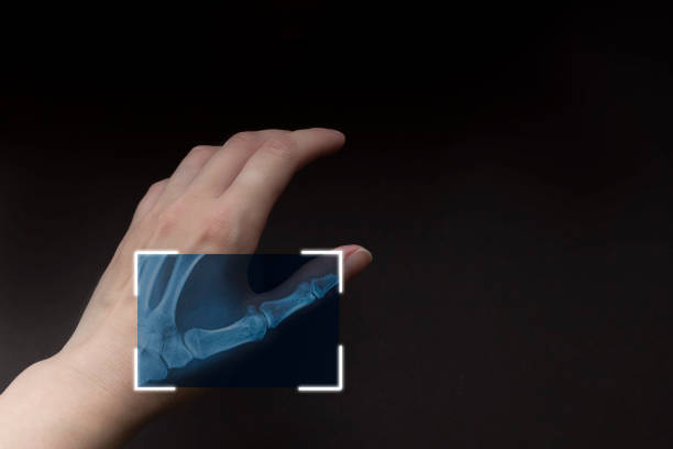 radiographie partielle de la main sur le fond brun, main de balayage, technologie futuriste avec biométrique. réseau de cybersécurité. - x ray x ray image human hand anatomy photos et images de collection
