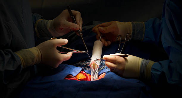 intervento di chirurgia cardiaca valvola aortica e aorta ascendente sostituzione - aorta foto e immagini stock