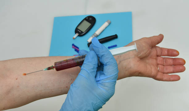 istock Laboratory assistant taking blood with syringe,Amfetamine, Speed, Crystal,Crystal meth 1251453216