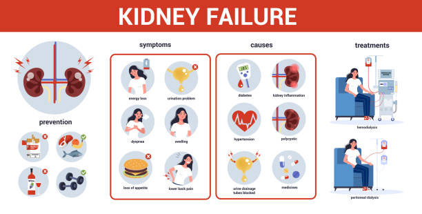 Kidney failure infographic. Symptoms, causes, prevention and treatment. Idea of medical Kidney failure infographic. Symptoms, causes, prevention and treatment. Idea of medical treatment. Urology, internal human organ. Healthy body. Vector illustration in cartoon style dialysis stock illustrations