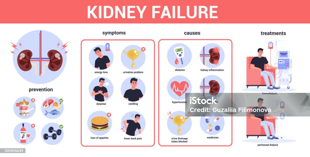 Image result for What Triggers Kidney Infection Symptoms? infographics