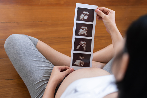 Happy Asian Pregnant woman looking ultrasound image while touch her belly at home. Young Mother holding sonogram of her unborn baby. Concept of pregnancy, Maternity prenatal care. Mom with a new life