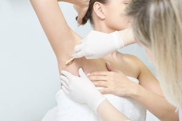 corpo da donna ceretta. depilazione dello zucchero. epilazione del servizio laser. procedura estetista in cera da salone - waxing armpit women beauty treatment foto e immagini stock