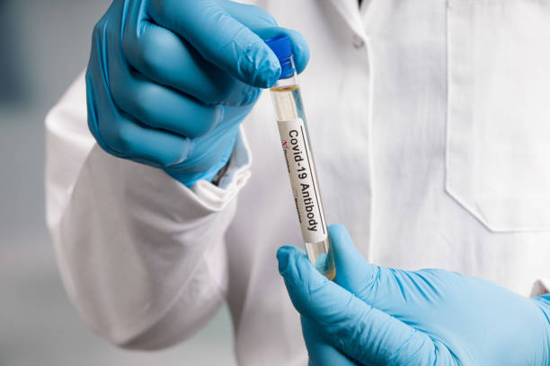 primer plano de las manos en guantes azules que manejan tubos de ensayo de anticuerpos después del análisis de virus con marcadores de resultados en un laboratorio médico - specimen holder fotos fotografías e imágenes de stock