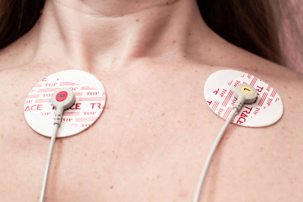 elektroden eines elektrokardiographen auf eine frauenbrust geklebt - pulse trace arrhythmia electrode listening to heartbeat stock-fotos und bilder