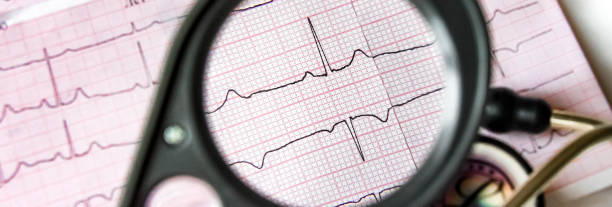 mirar más de cerca la impresión ecg a través de una lupa - blood cardiologist color image nobody fotografías e imágenes de stock