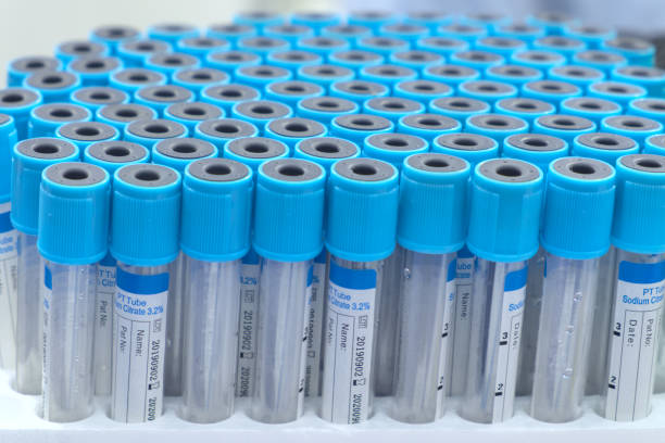 istock Group of blue sample tube 1252036290