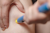 Woman using a pre-filled syringe or pen injection into the femoral area, closeup, herself medical shot, injector for diabetes or allergy