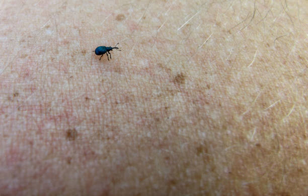 istock beetle on the human skin. parasite close-up 1252400879