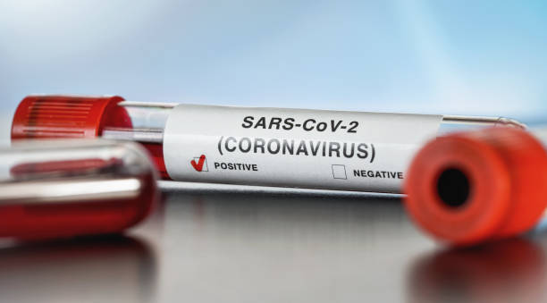 istock Sample vial with blood, label says SARS-CoV-2 coronavirus, positive result. Covid 19 testing during outbreak concept 1252611697