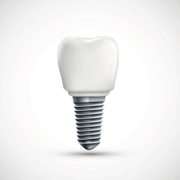 Dental implant icon. Isolated on white background. Dental implant icon. Isolated on white background. Vector illustration. orthodontic logos stock illustrations