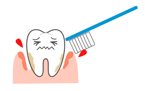 choroba przyzębia krwawiąca pasta do zębów - human teeth gums dental hygiene inflammation stock illustrations
