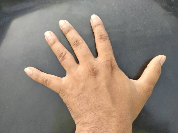 istock Human hand fingers male female 1252818408