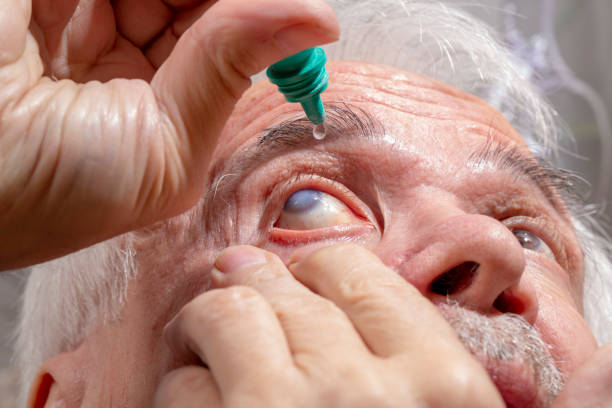 istock Elderly man buries medicine in his eyes 1252830381