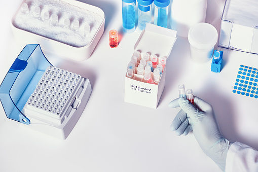 Quick novel COVID-19 coronavirus test kit. 2019 nCoV pcr diagnostics kit. Hand in glove with tubes. RT-PCR kit detects covid-19 corona virus in patients samples. Test for real-time PCR amplification.