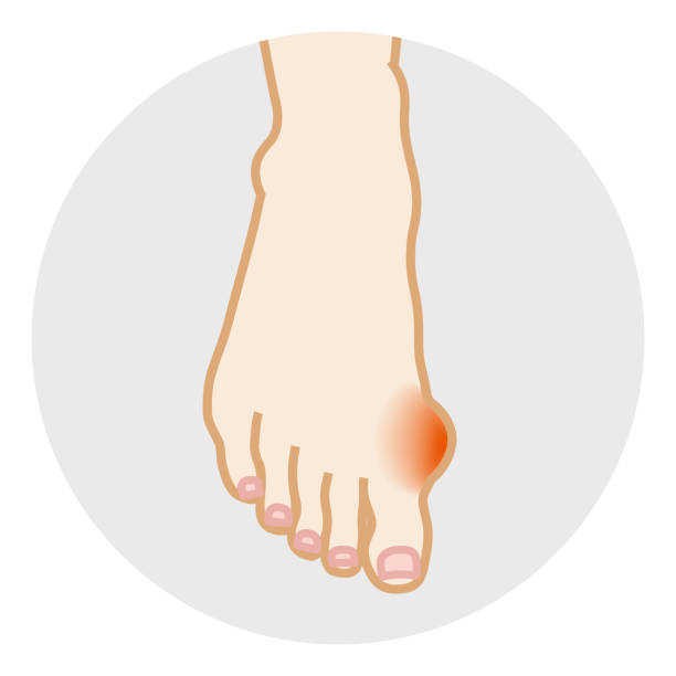 할로 발거스 - 발 바디 파트 - human foot pain white background isolated stock illustrations