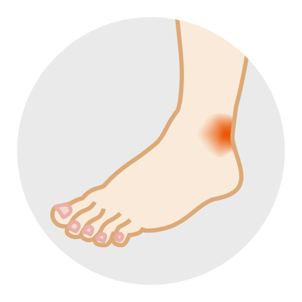 신발 아픈 - 발 증상 - human foot pain white background isolated stock illustrations