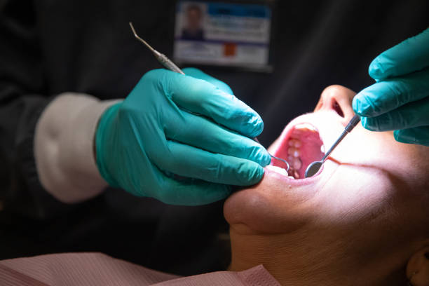 a dentist wearing surgical gloves uses a loupe light to examine the teeth of a female patient in her sixties in a dental clinic - dental light dental equipment hospital professional occupation imagens e fotografias de stock