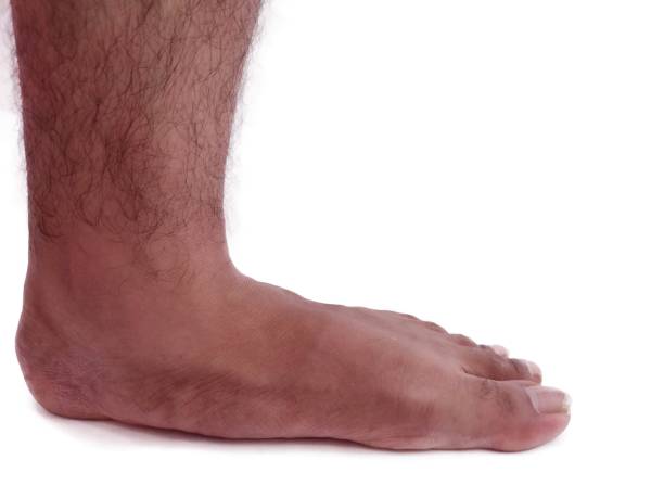 istock Man bare feet with hairs lateral view stand on white background Isolated 1253031188