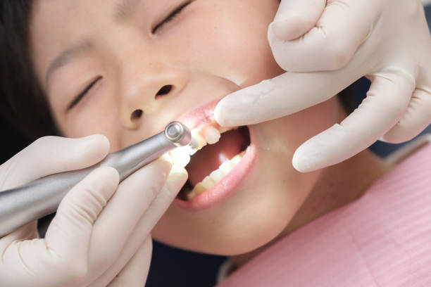 japanese children using an interdental brush at the dentist - dentist child dentist office human teeth imagens e fotografias de stock