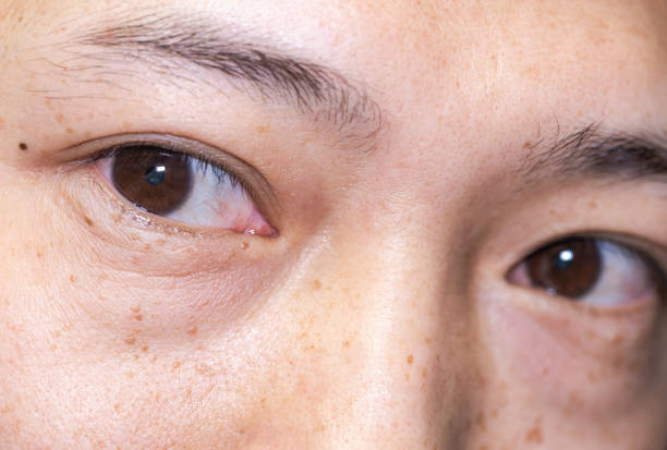 istock Men eye Extreme close-up 1253060143