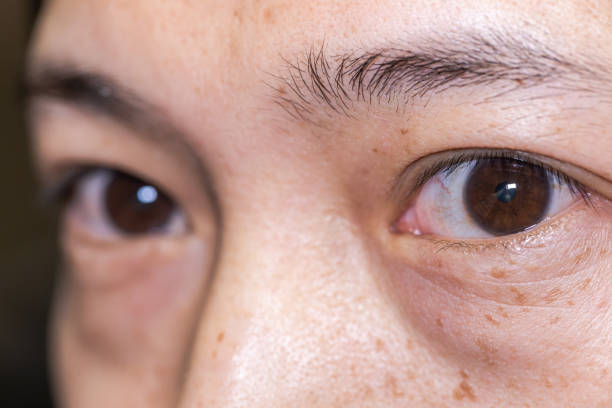istock Men eye Extreme close-up 1253060351
