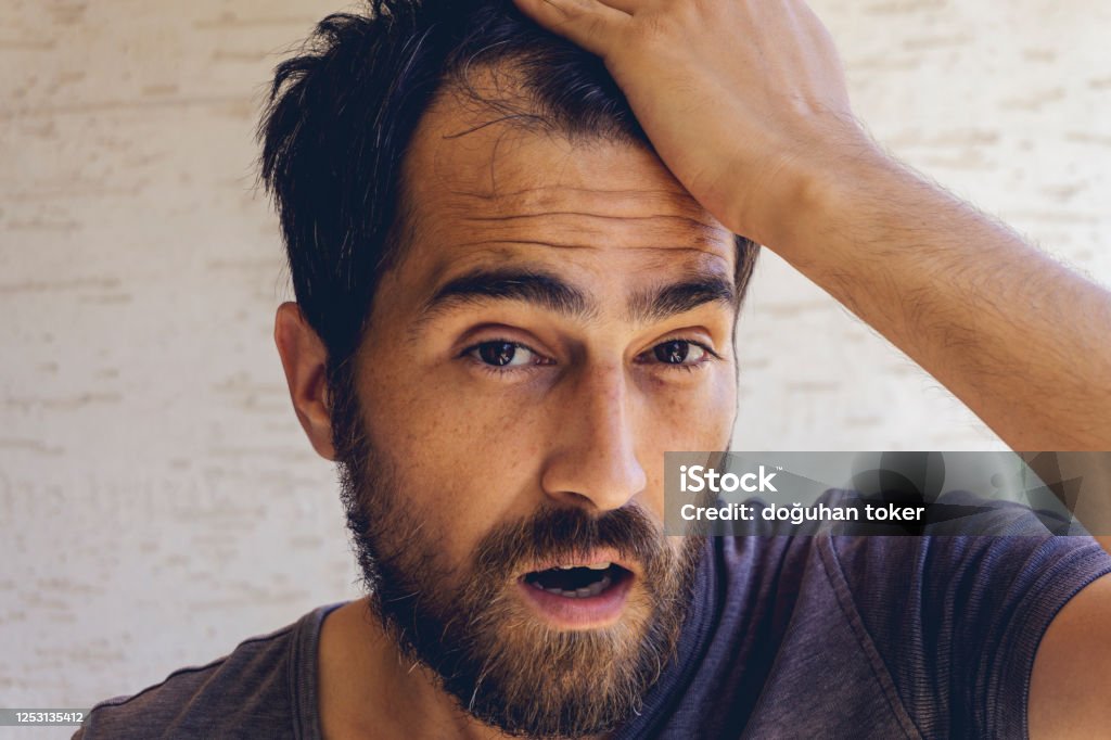 Man Using His Hand Slicking His Hair Back After Facing Hair Loss Problem By Taking Medicine Like Zinc And Biotin To Make His Hair Grow Faster And Thicker Men Health And Medical Man Using His Hand Slicking His Hair Back After Facing Hair Loss Problem By Taking Medicine Like Zinc And Biotin To Make His Hair Grow Faster And Thicker Men Health And Medical