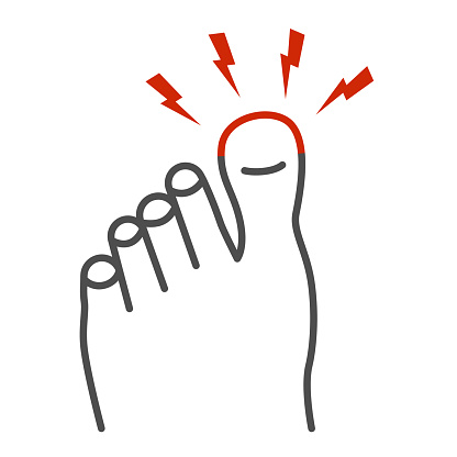 Sore big toe thin line icon, Body pain concept, Foot pain sign on white background, leg with a toe injury icon in outline style for mobile concept and web design. Vector graphics