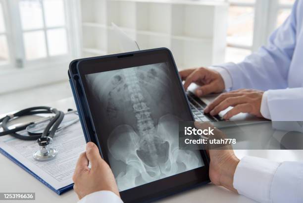 Doctor Diagnose Spine Xray Stock Photo - Download Image Now - X-ray Image, Spine - Body Part, Doctor