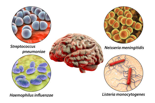 eziologia della meningite batterica - listeria foto e immagini stock