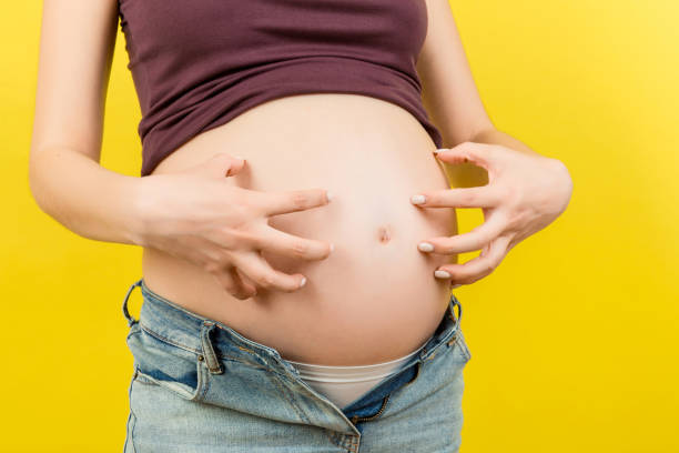 Close up of pregnant woman dressed in opened jeans scratching her belly at colorful background with copy space. Problem of stretch marks concept Close up of pregnant woman dressed in opened jeans scratching her belly at colorful background with copy space. Problem of stretch marks concept. scuff marks photos stock pictures, royalty-free photos & images