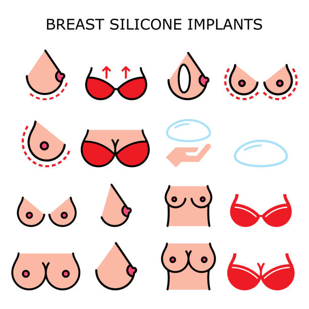 Breast silicone implant, boob job breast augmentation, reconstruction surgery vector color icons set - plastic surgery Mammoplasty, increase the size of brest design set, female body with small and big breast silicone implants stock illustrations