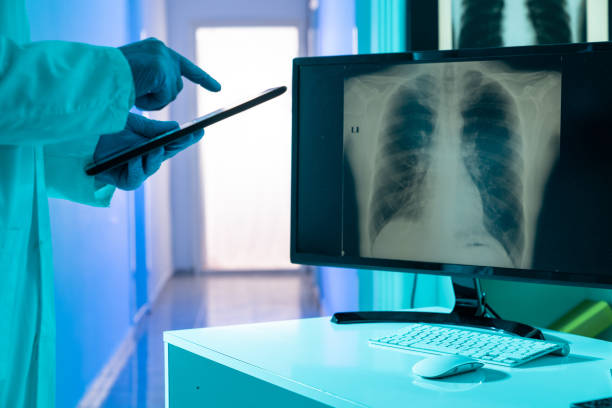 istock Radiology Doctor Wearing Lab Coat And Checking X-ray Image Of Chest While Using Digital Tablet 1253553916