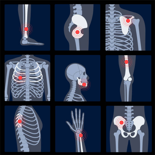 Pain4_Skeleton Human man skeleton pain, fracture or inflammation, parts of male body on x ray view. Vector isolated flat illustration of skull and bones on reontgen. Medical, educational or science banner. hip joint x stock illustrations