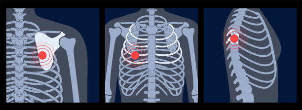 ilustrações de stock, clip art, desenhos animados e ícones de pain4_skeleton - pain rib cage x ray image chest