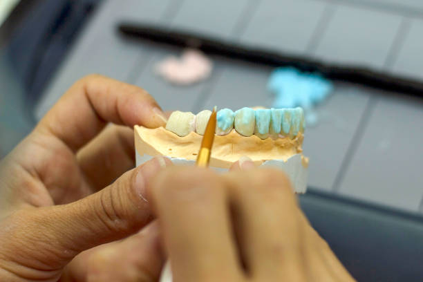 istock full tooth and whole dental prosthesis construction 1253607657