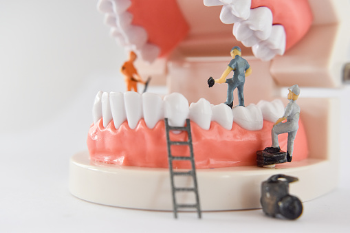 miniature people to repair a tooth or worker cleaning tooth model as medical and healthcare. Idea for cleaning dental care or dentist.
