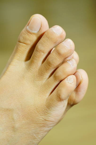 istock Close-up woman foot 1253676969