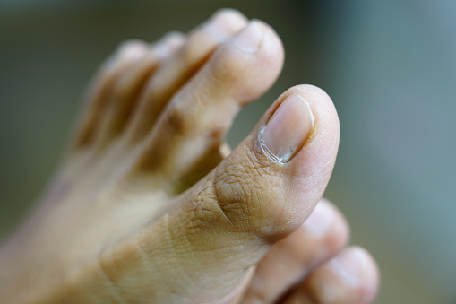 Close up of Female feet in Asia.