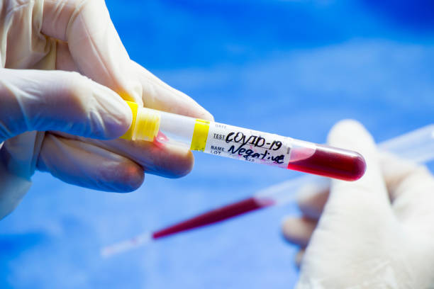 istock Corona virus negative blood test tubes on the white background, studio shoot. Blood test samples. Diagnosis and laboratory. 1253715855