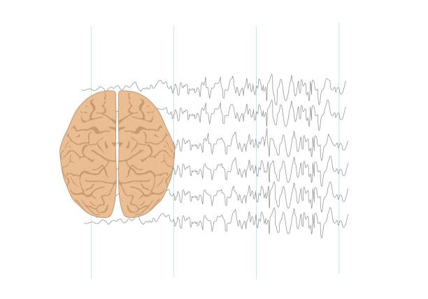 ilustrações de stock, clip art, desenhos animados e ícones de illustration of human brain and abnormal brain waves - eeg epilepsy science electrode