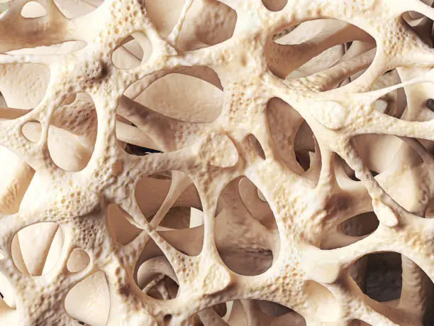 Realistic bone spongy structure close-up, bone texture affected by osteoporosis, 3d illustration