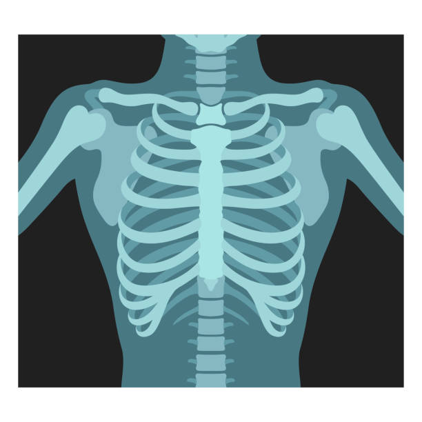 胸郭x線。肺放射線制御。胸部、肋骨、胴体のレントゲン写真。フッ素撮影。 - pain rib cage x ray image chest点のイラスト素材／クリップアート素材／マンガ素材／アイコン素材