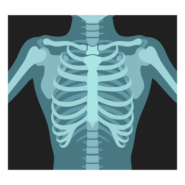 Thorax x-ray. Lungs radiological control. Radiography of chest, ribs., torso. Fluorography. Thorax x-ray. Lungs radiological control. Radiography of chest, ribs., torso. Fluorography, tuberculosis examination. Human skeleton bones. Medical anatomical vector illustration. roentgen stock illustrations